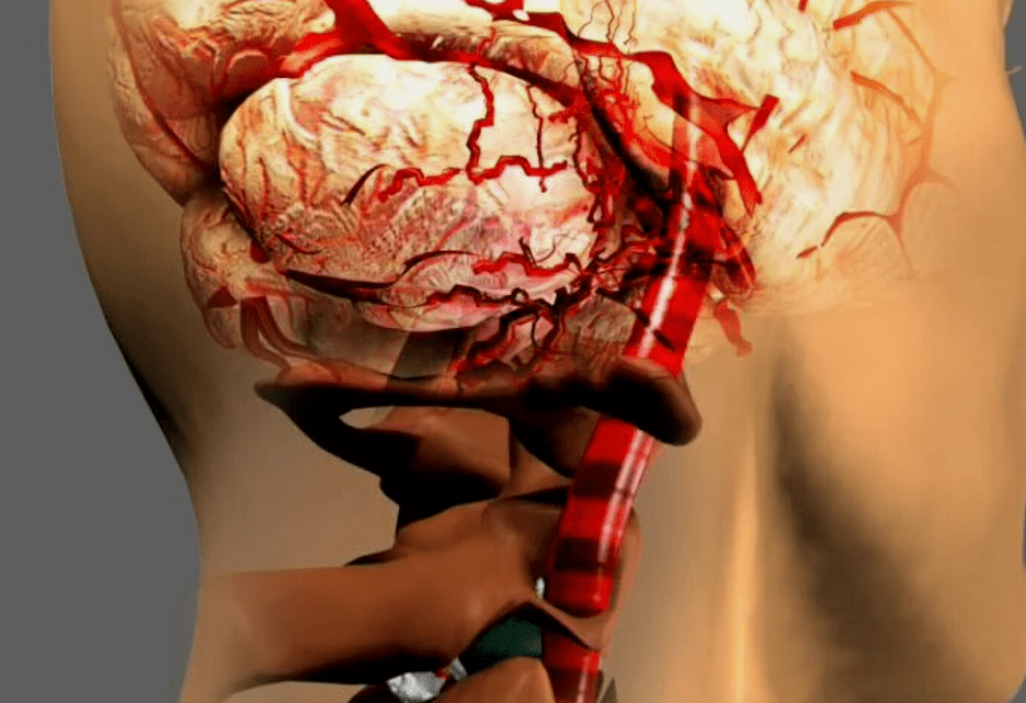 que a osteocondrose cervical é perigoso