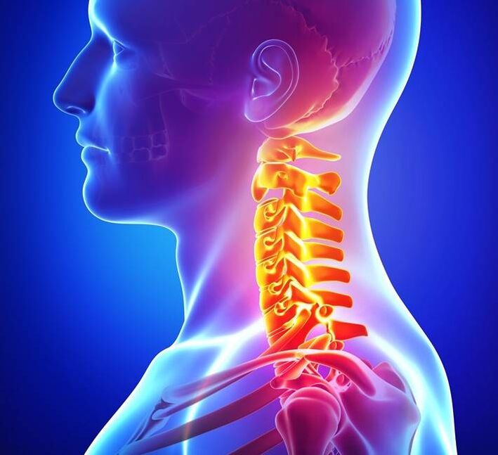 Osteocondrose da columna cervical